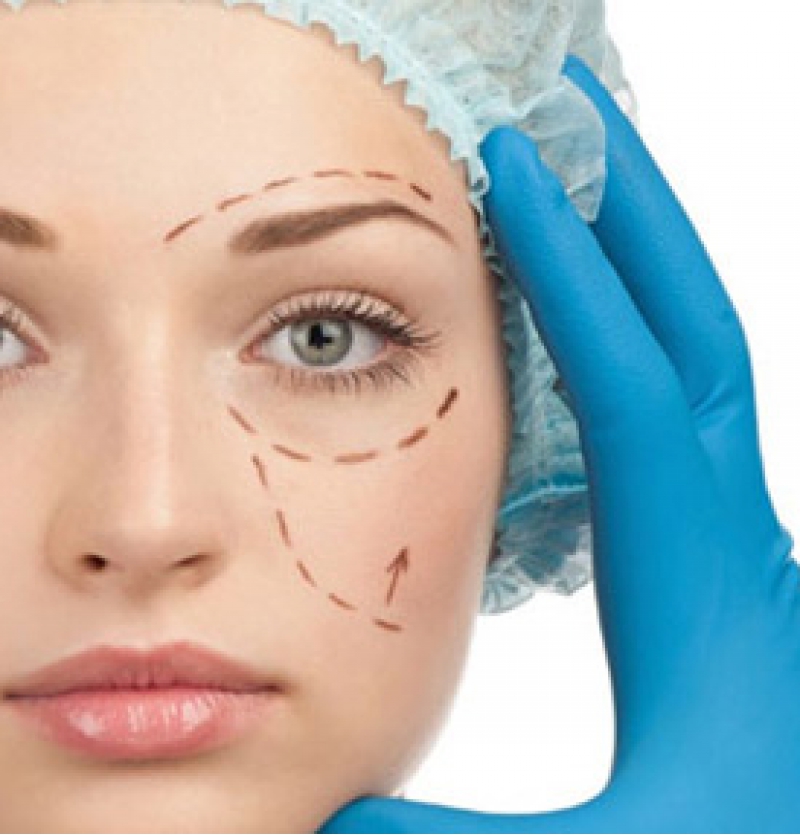 جراحة الجفن