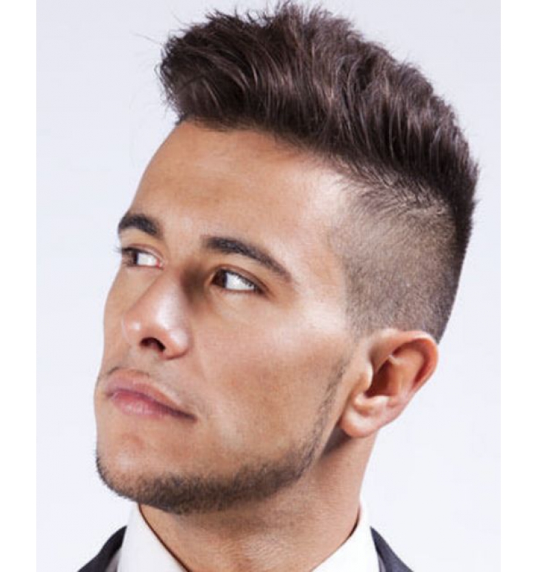 أنواع زراعة الشعر في ايران