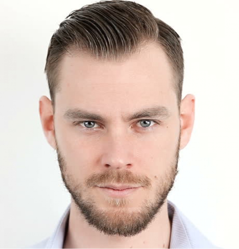 طريقة زراعة الشعر